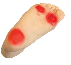 <a href=''><span style='color:#2f82c5; display:inline; font-weight:bold;'>Diabetic foot Care model</span></a>